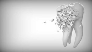 endodontija